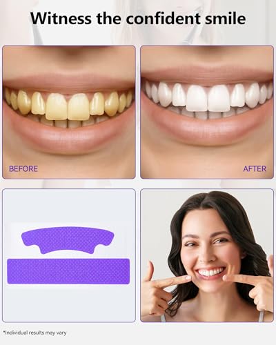 Image of Teeth Whitening Strips, Purple, Enamel Safe, Sensitive, 7 Treatments | Whitens Teeth, Purple Whitening Strips, Removes Yellow Stains and Bad Breath, Color Correction