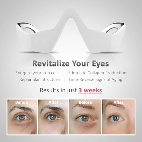 ENLIWISH Heated 3D Eyes Wrinkle Massager, 160g, Red - Image 4