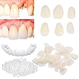 Tooth Repair Kit for Fixing the Missing Chipped and Broken Tooth Gap Temporary Replacement Thermal B