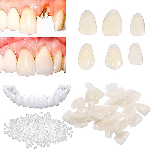 Tooth Repair Kit For Fixing The Missing Chipped And Broken Tooth Gap Temporary Replacement Thermal Beads And Fake Teeth Brace Mold #TOP2