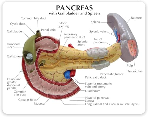 Pancréas pathologique AMITD modèle anatomique avec duodénum pour démonstration médicale - 6