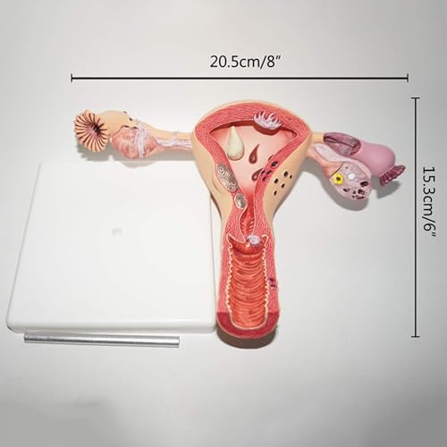 Modèle utérus et ovarien de taille réelle AMITD pour éducation médicale - 8