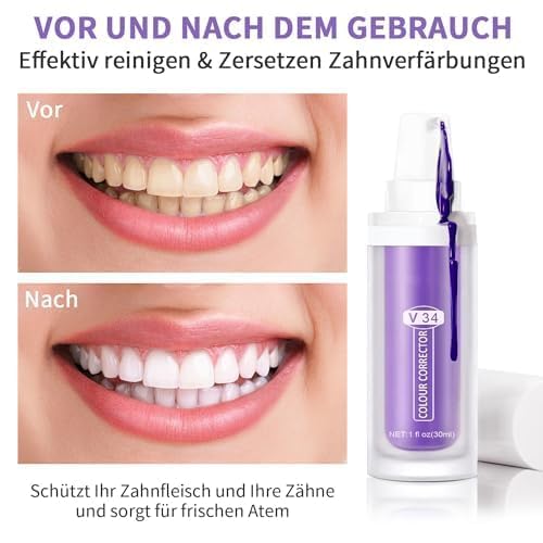 Zahnpasta Weisse Zähne,Strahlend Weiße Zähne,Zahnfleisch Reparatur,Effektive Verfärbungsentfernung,Schonende Zahnfleischpflege