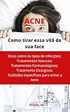  ACNE: Tire essa Vilã da sua Face (Portuguese Edition)