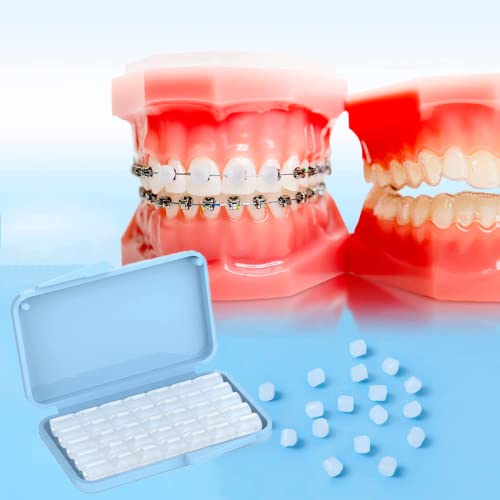 Vorgeschnittenes Kieferorthopädisches Wachs | Dentalwachs für Zahnspangen (10 Kisten, ohne Aroma)