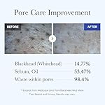 Medicube Zero Pore Blackhead Mud Facial Mask - Skin Cooling & Pore Tightening - 3 Minute Quick Dry Formula with AHA, BHA, PHA, and Pore-Purifying Clay - Korean Mud Mask 3.52 oz - Image 5
