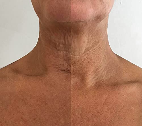 My Instant Effects Neck And Chest Rejuvenating Serum For Women - Helps Hydrate And Revive Your Skin - Very Quickly Brightens Beautiful Skin - Helps Speed Up Skin Renewal - 1 Oz #TOP3