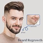 5% Minoxidil Spray for Men and Women, Minoxidil for Women Hair Growth, Minoxidil for Men Hair Growth Spray 2PCS. - Image 3