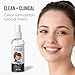 Quitch Stye Eye Treatment, Hypochlorous Acid Spray, Eye Cleansing Spray, Eyelid and Eyelash Cleanser, Lid Scrub, Eyelash Extensions Cleanser, Lash Cluster Tech Supplies Kit, Wash for Lashes