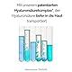 M. Asam AQUA INTENSE Hyaluron Serum (100 ml) – Hochdosiertes Feuchtigkeitsserum mit patentiertem Hyaluronsäurekomplex, Aufpolsternd und reduziert Falten, Parfümfrei, Ideal für sensible Haut