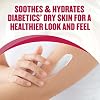 Gold Bond Diabetics' Dry Skin Relief Body Lotion, 13 oz., With Aloe to Moisturize & Soothe, Diabetic Lotion for Dry Skin