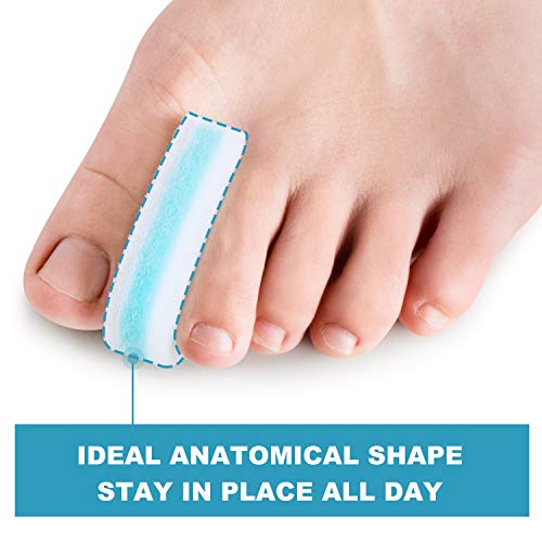 Bukihome-Bunion-Corrector-Toe-Separators-6-Pack-Foam-Toe-Spacers-for-Overlapping-Toe-Big-Toe-Straightener-to-Relieve-Bunion-Pain-Prevent-Blister-Corn