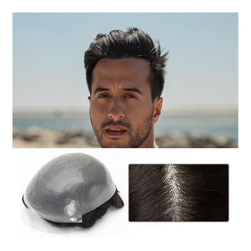 Système remplacement européens pour masquer la calvitie masculine