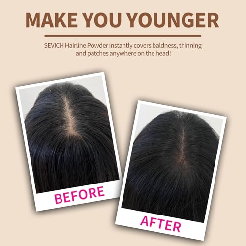 Sevich AMNAIFQNV-63 Hairline Powder,Instantly Conceals Hair Loss, Root Touch Up Powder thumb #2