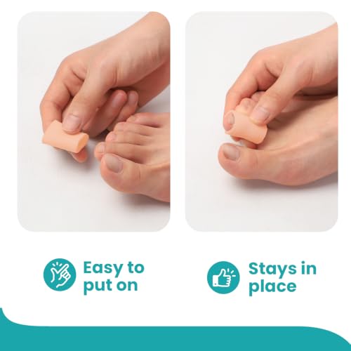Image of Silicone Toe Protectors - 20 Pack Silicone Toe Sleeve for Hammer Toes, Corns, Calluses, Blisters - Soft Gel Toe Tube Pads for Pain Relief(Beige)