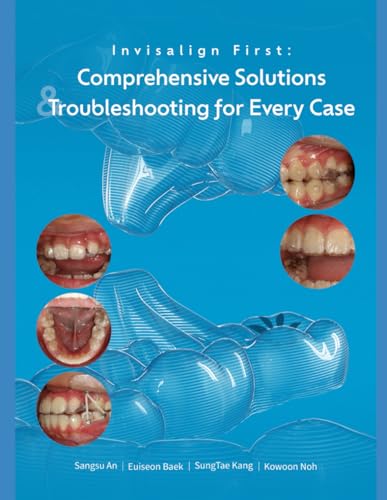 Invisalign First Comprehensive solutions and Trouble shooting for every case: A Step-by-Step Guide to Mixed-Dentition Clear Aligners, Digital Planning and Clinical Troubleshooting Invisalign first