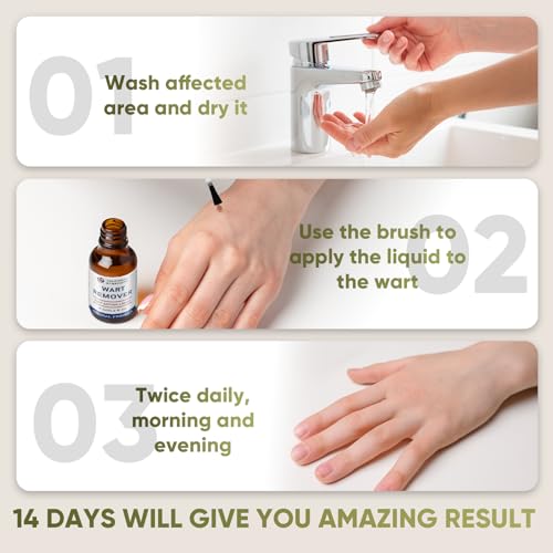 Image of inchSTAY STOKED inch Wart Remover, 15ml Salicylic Acid Wart Remover - Gentle Yet Powerful for Plantar Warts, Flat Warts & Calluses, Safe for Daily Use on Hands, Feet & Skin-H5515