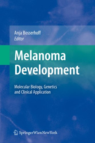Melanoma Development view 2