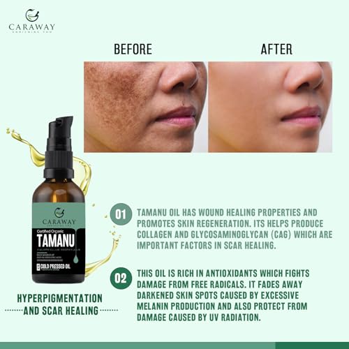 CARAWAY Tamanu Oil Organic for Skin - Cold Pressed - Natural Moisturizer for Dry Skin, Face and Hair - Helps Treat Hyperpigmentation, Acne scars, Eczema, Psoriasis- 1.7 Fl oz - 50 ml