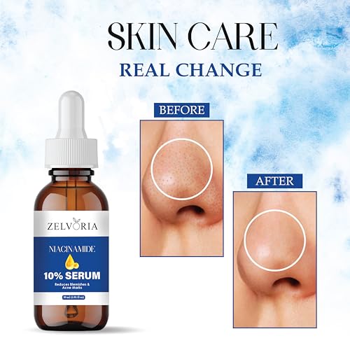 Image of 10% Niacinamide Face Serum with Hyaluronic Acid, Vitamin C & E | Brightening, Hydration & Oil Control | Reduces Acne Marks & Pores | Serum for Men & Women | Suitable for All Skin Types (30ML)