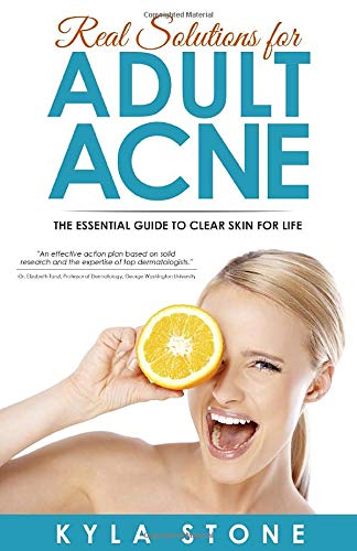 Real Solutions for Adult Acne: Cure Hormonal Acne with Science-Backed Treatments that Work