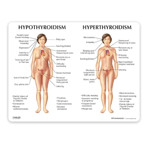 Modèle de thyroïde et réplique anatomique humaine pour cabinet médical