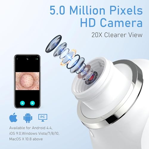 Image of Facial Pore Blackhead Remover Vacuum, 1080P Camera Blackhead Remover, 20x Zoom, 8 LEDs & 3 Suction Modes, 800mAh Battery & USB - 6 Heads Pore Cleaner Kit for Women&Men(White)