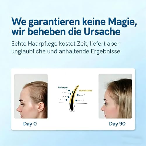 Rosmarin Haarwachstumsserum Roll On, Roll-On Haarserum Für Haarausfall Reduzieren,Rosmarin Haar-Roller-Serum, Blockierendes Kopfhautserum fördert den Sauerstofffluss, 2 Stück Für Männer & Frauen