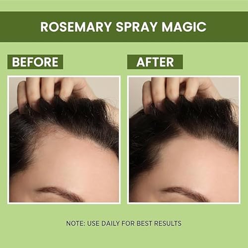 Image of Drontika Bioleaf Botanicals Rosemary Water Spray for Hair Growth & Hair Thickness with Rice Water & Henna |100% Natural Extract | Soft & Smooth Hair| Controls Hairfall| Non-Greasy & Fast Absorbing | 200 ml