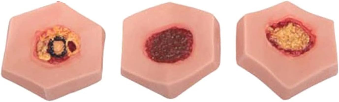 Modello di allenamento con simulatore di piaghe da decubito, kit per la cura delle ferite da decubito, 4 fasi di piaghe da decubito, strumento di pratica infermieristica per l'educazione medica
