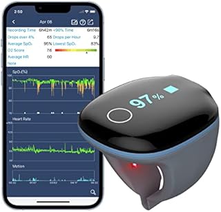 Wellue O2Ring Oxygen Monitor - Pulse Oximeter Bluetooth Recording blood oxygen level and Heart Rate, O2 Tracker with Free APP Records | iF Design Award Winner