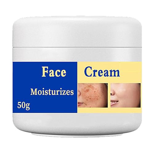 Mnozreo Crema Blanqueadora Para Pecas,Elimina Manchas Oscuras,50G,1PC,Crema Hidratante Aclarante y Anti Manchas, Reduce El Melasma
