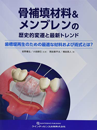 骨補填材料&メンブレンの歴史的変遷と最新トレンド