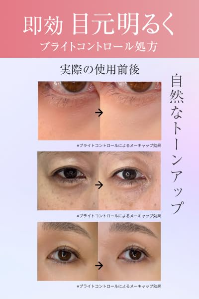 Amazon.co.jp: ニードルセラムブライト 針美容液 【公式】lujo