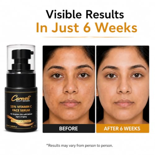 Image of 15% Vitamin C Face Serum with 5% Niacinamide, 1% Hyaluronic Acid, 0.5% Ferulic Acid & 0.1% Vitamin E | Face Serum for Glowing Skin, Dark Spots Appearance, Uneven Skin Tone & Hydration | Lightweight & Non-Sticky (30 ml)