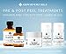 ASDM Beverly Hills Post Peel Treatment Serum 2oz 60ml Medical Strength AHA BHA Chemical Peel Neutralizer, w/Organic Tepezcohuite, Balance Skin PH, Reduce Irritation Inflammation, Accelerate Healing