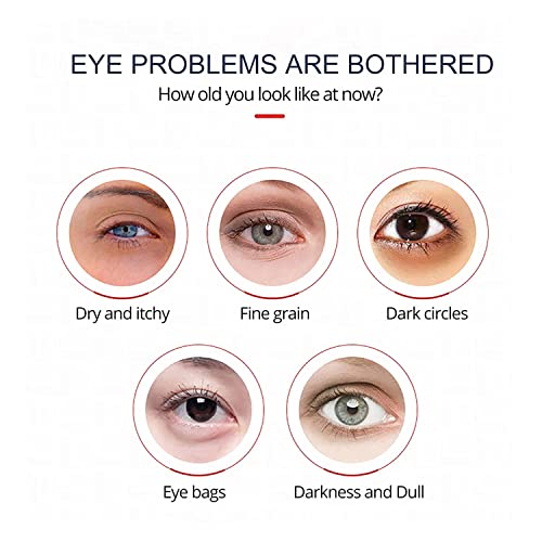 2Pcs Openeyes Awaken Peptide Lifting Eye Gel【Magic Effect】Himse Awaken Peptide Depuffing Eye Gel, Openeyes Peptide Lifting Eye Gel - Reduces Puffiness/Dark Circles/Under Eye Bags/Wrinkles #TOP3