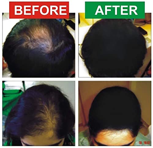 Image of NEW ! Hairouse Natural Hair Building Fibre (Natural Black) 25 Gms | Microfibers to Cover Bald Patches, Hair Thinning, Instant Volume & Fuller Look for Men & Women | Ecofriendly & Biodegradable | 99% Plant Cellulose