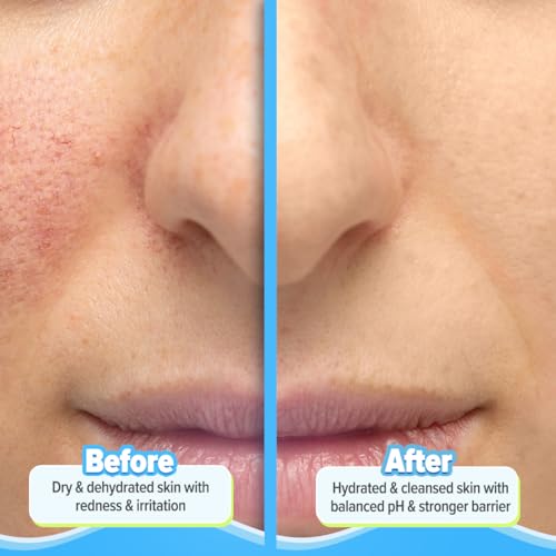 Image of Aqualogica 5 Barrier+Repair Gentle Face Cleanser With Avocado&5 Essential Ceramides-100Ml| Dry To Normal,Sensitive Skin|Strengthens Skin Barrier|Non-Oil Stripping|Gently Cleanses&Hydrates|Men&Women