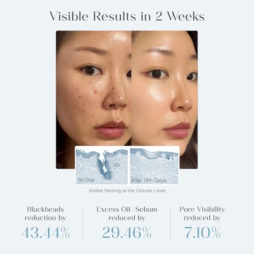 SeoulSkin Zero Pore Toner Pads 70 Count - Image 6