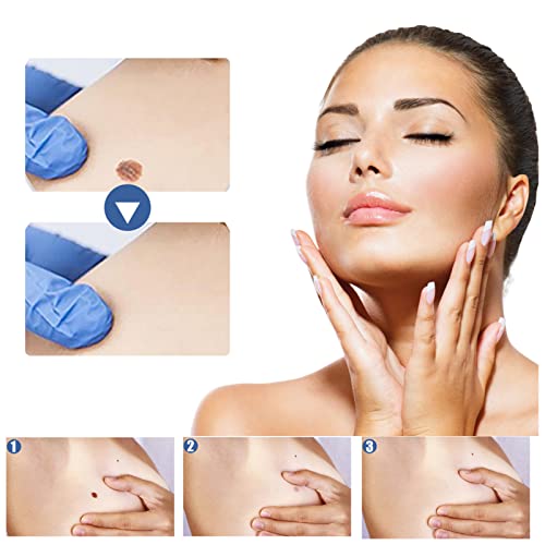 Adesivo removedor de verruga Mingzhe Skin T-ag removedor de verrugas ingredientes naturais 144 peças