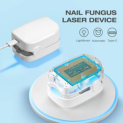 Resctol Nail Fungus Cleaning Laser Device For Toenail Fingernails & Onychomycosis, Home Use Nail-Fungus Remover By 905Nm Infrared Light + 470Nm Blue Light #TOP2