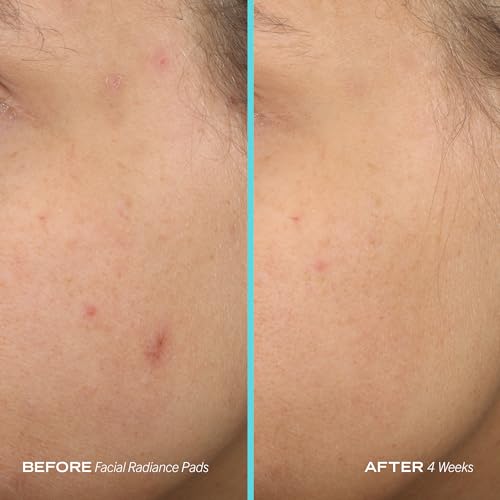 First Aid Beauty 36468 Facial Radiance Pads thumb #6