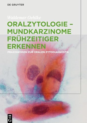 Oralzytologie - Mundkarzinome frühzeitiger erkennen: Praxiswissen zur Oralen Zytodiagnostik (German Edition)