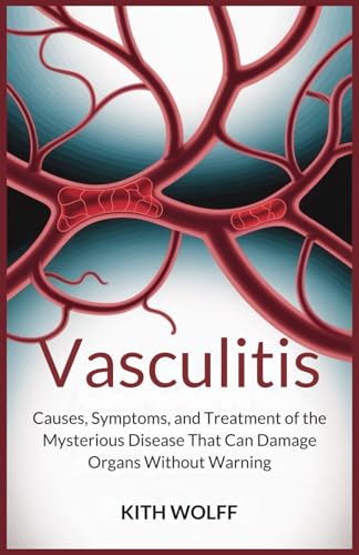Vasculitis: Causes, Symptoms, and Treatment of the Mysterious Disease That Can Damage Organs Without Warning