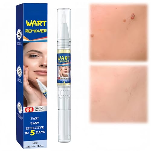 Wa/rt Removal Pen,Tags and Mole Remover Pen,Skin T/ag Remover Pen,Effective Wart Remover for Face,Wa/rt Reamoval for All Skin Types,Natural M/oles Pen for Foot and Hand,Gentle Skin T/ag Liquid Pen