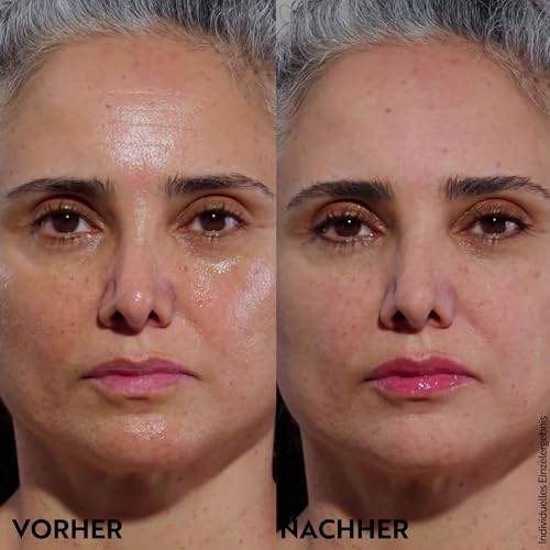 M. Asam Magic Finish Summer Teint Mit LSF 30 (30ml), 4-in-1 Primer, Make up, Puder & Concealer, Kaschiert, Gleicht Aus, Verschönert & Perfektioniert Deinen - Für Gebräunte Haut, vegan