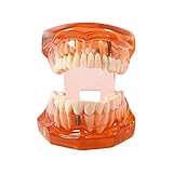 Demonstratives Implantatmodell & fixed Prothetik auf Implantat.