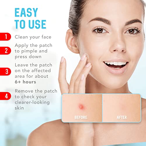 Pimple Patches (120 Pack), Hydrocolloid Acne Patches with Tea Tree Oil