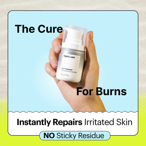 Tropic Labs Over Exposed Soothing After Sun Gel - Cooling Aloe Vera Alternative For Skin Recovery, Relief Of Sunburn. Beach Essentials For Women, Men & Kids Travel Size 1.7Oz #TOP1